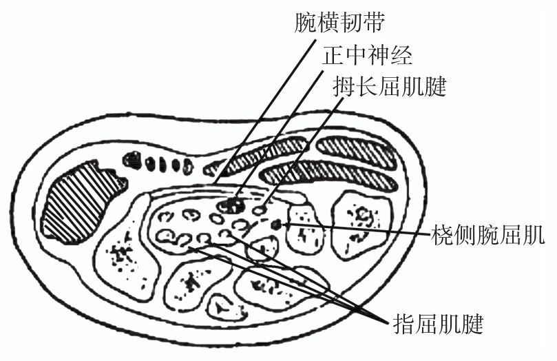 腕管的构成 腕管是腕部的一个骨纤维管道,由背侧