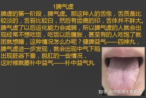 痰湿体质应该如何调理? - 知乎
