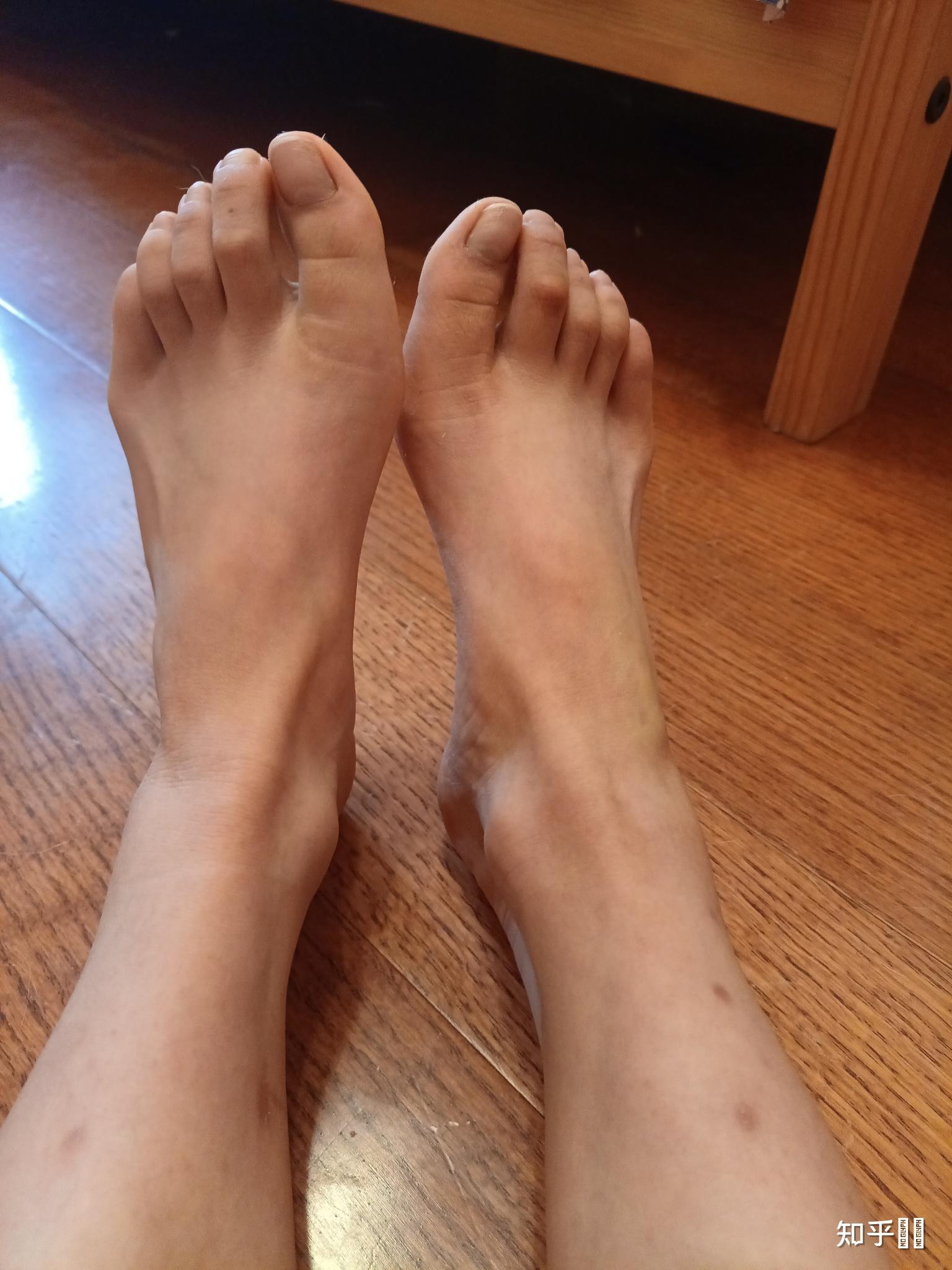 女生有一双很丑的脚有什么体验