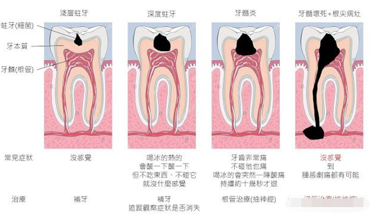 怎么才能让牙神经不疼了 v2-c9ca931453ed2672a1911bd34fc3e136_1200x500.jpg