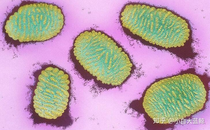 什么是黑死病病毒 v2-c9d62e6f134478429547689cd281dc6d_r.jpg