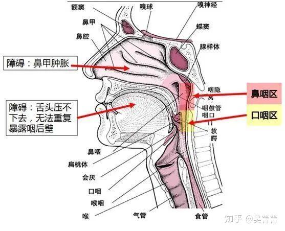咽后壁位置图图片