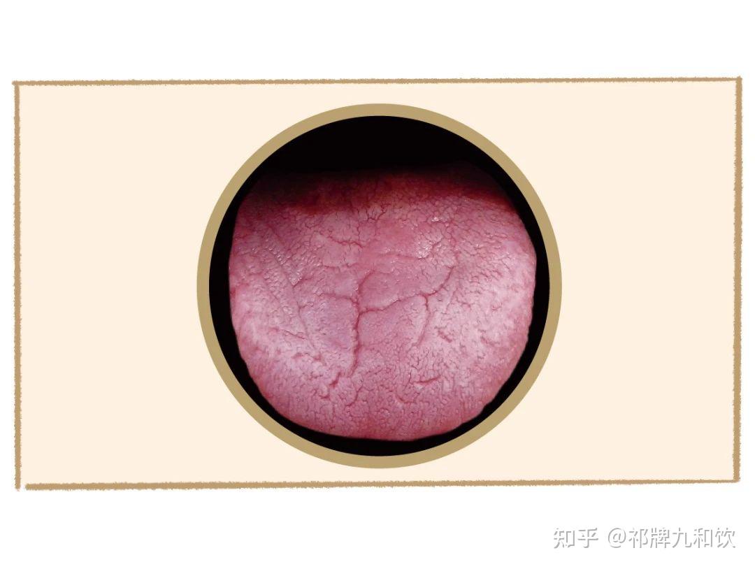 中医舌诊图谱来啦!看舌头知健康 通过舌象看看你是什么体质? - 知乎