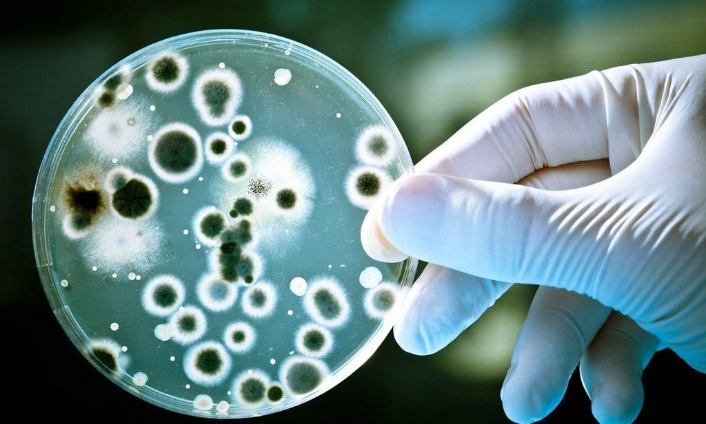 细菌也分好坏千万别把它们全杀死