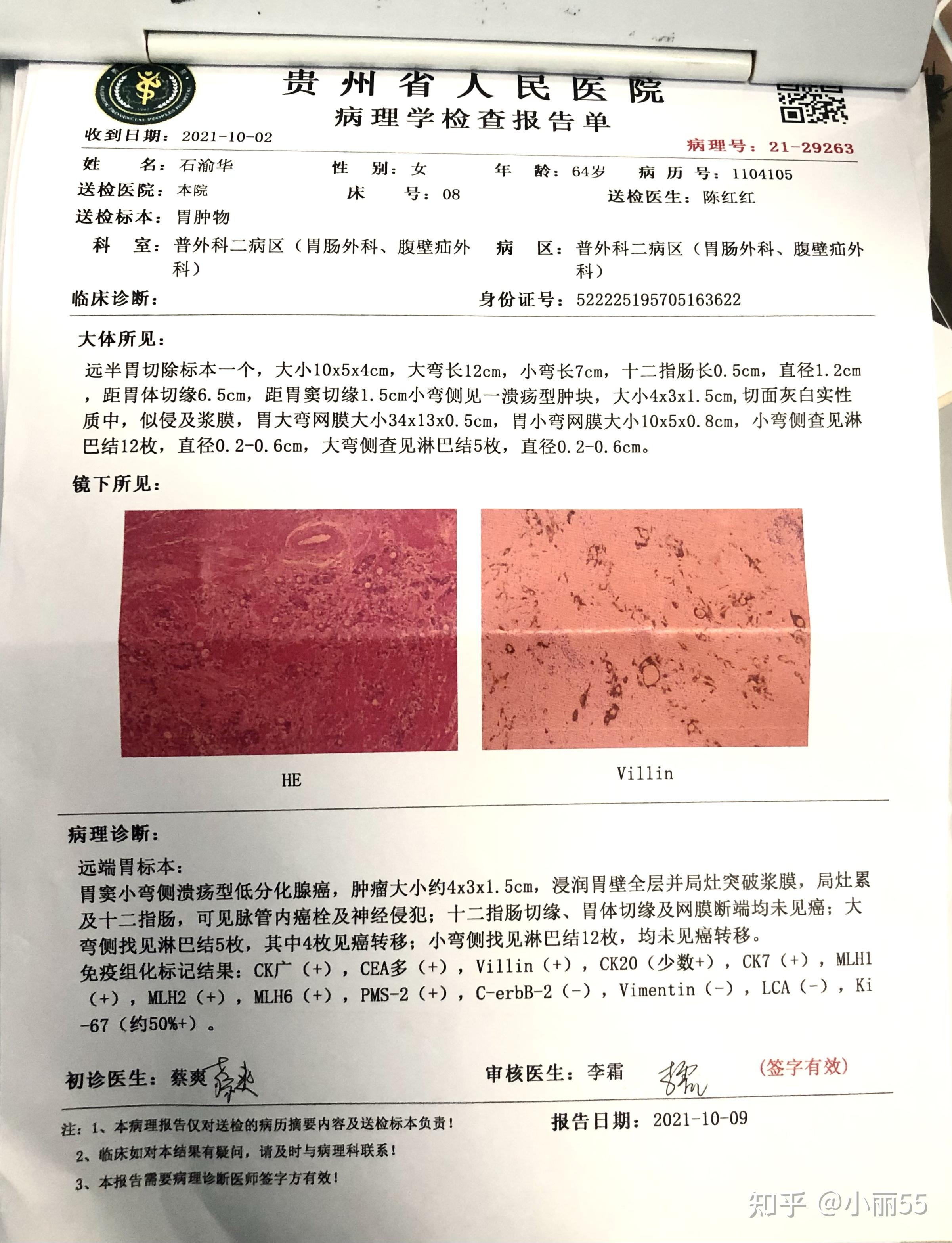 跪求医生指导建议胃腺癌低分化手术出来分期到t4