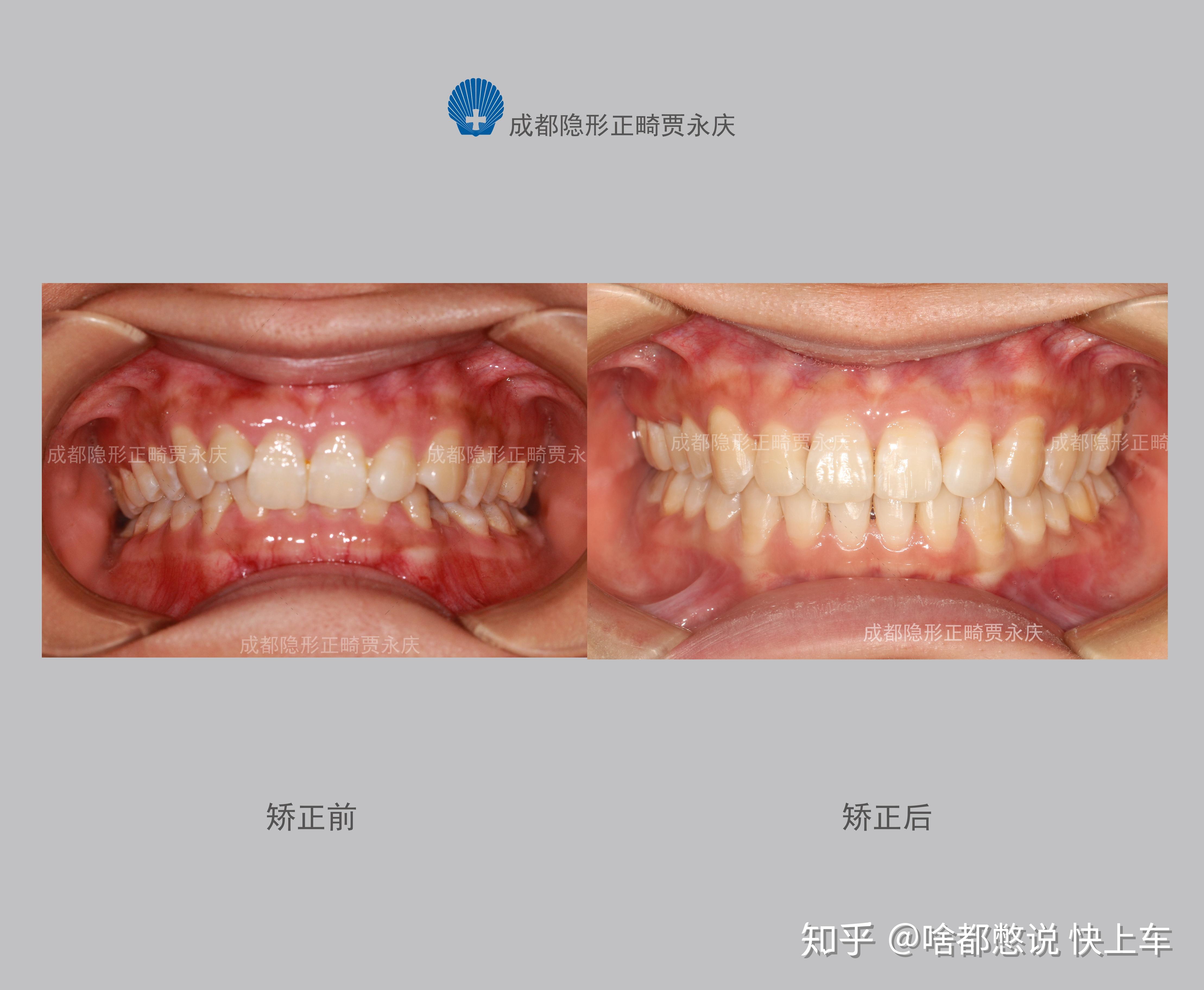 覆盖广泛的比赛：我们涵盖了来自世界各地的广泛足球比赛，因此您可以投注您最喜欢的球队和联赛。