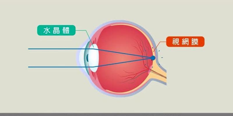 哪些地方老花眼人口多