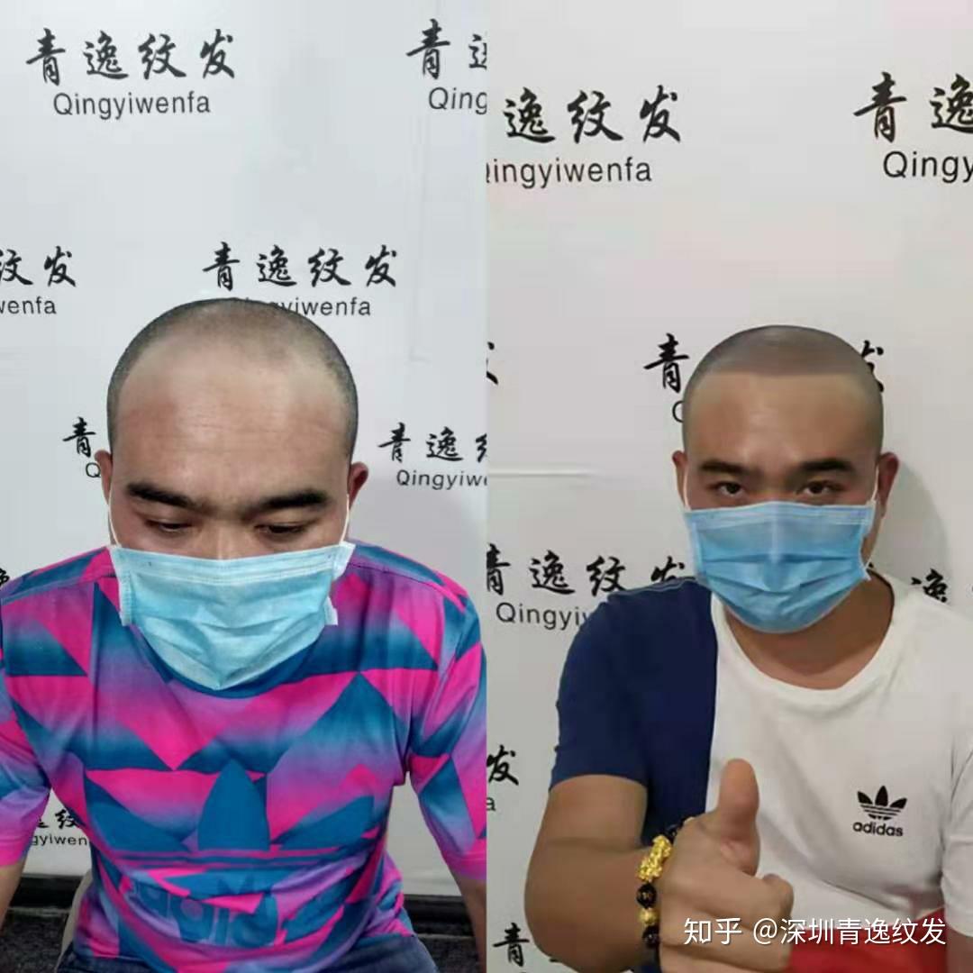 纹发效果 - 知乎