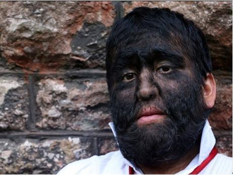 人类基因突变人类智力情感能力不断衰退人类说话foxp2的基因欧洲人