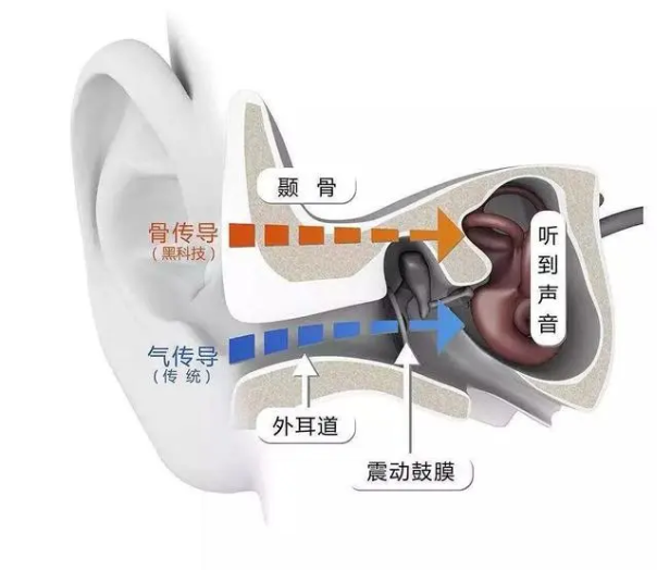 听诊器的原理图片