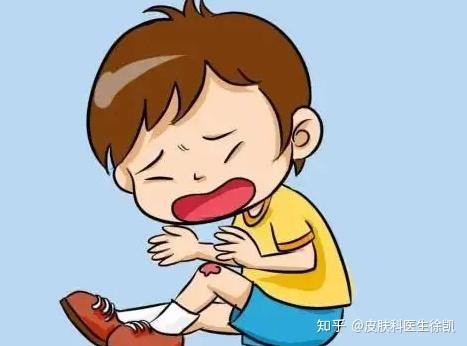 擦伤留下红印半年没有消怎么办?擦伤留下红印半年了如何治疗? - 知乎