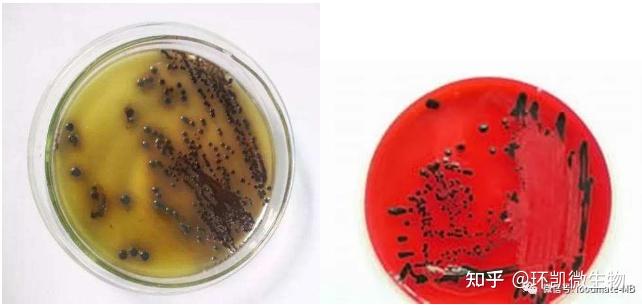 【速看】常见微生物在常见选择性培养基上的菌落特征 知乎