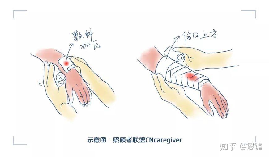 伤口处理的方法及注意事项