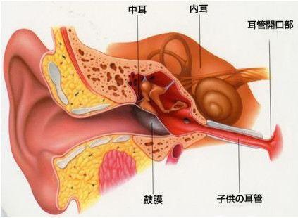 首大李健东 钛质人工听骨 架起听力重建的桥梁 知乎