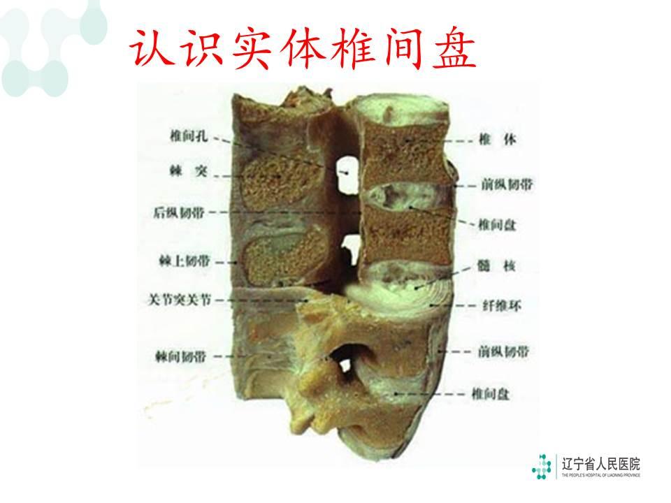 实体椎间盘腰部脊柱结构点击查看完整直播回顾视频地址:辽宁省沈河区