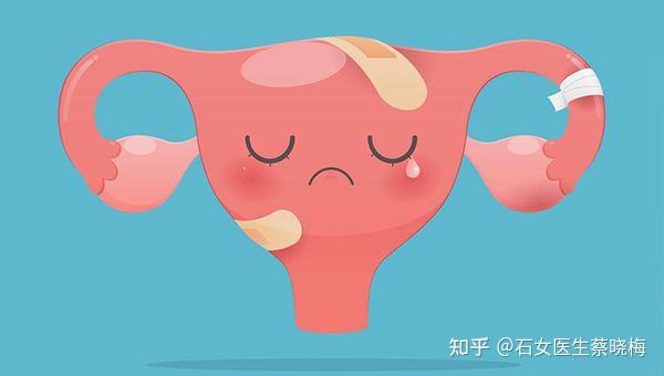 幼稚子宫的危害是什么? - 知乎