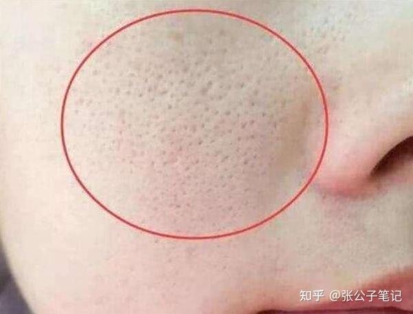 夏季油皮正确护肤思路,掌握三个护肤小技巧,帮你改善大油皮 - 知乎
