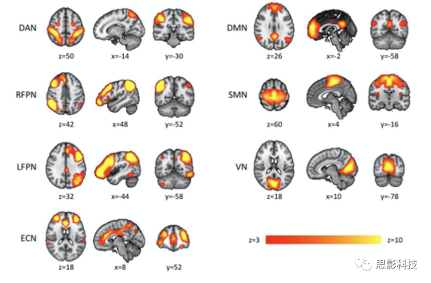 思影科技功能磁共振(fMRI)数据处理业务 - 知乎