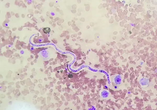 蚊子已经很可怕了,而这些吸血昆虫能让你感受真正的恐惧