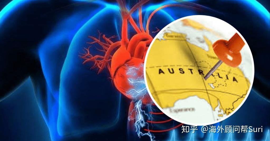 澳大利亚tga认证是什么意思？ - 知乎