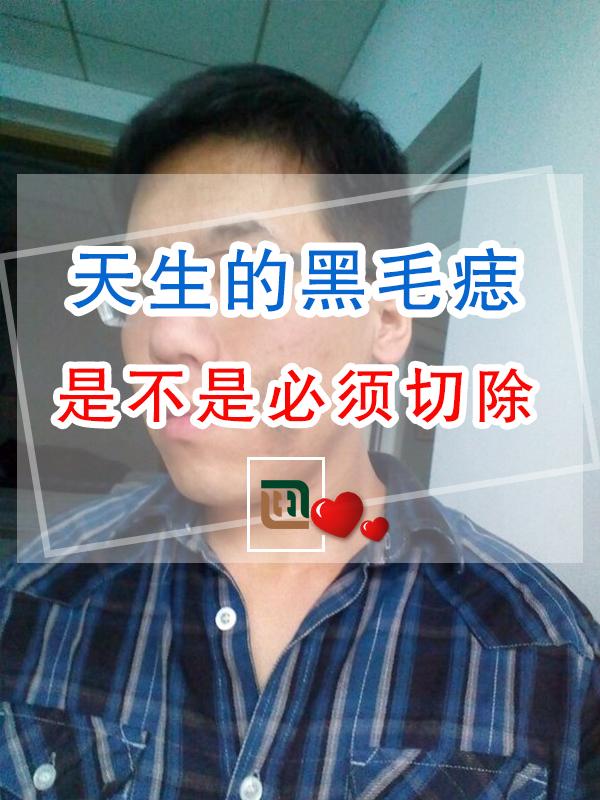 天生的黑毛痣是不是必须切除