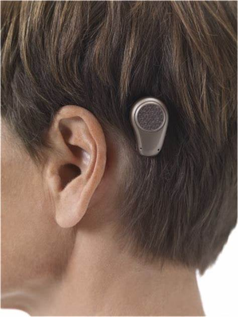 骨导助听器的工作原理是什么?效果好不好?