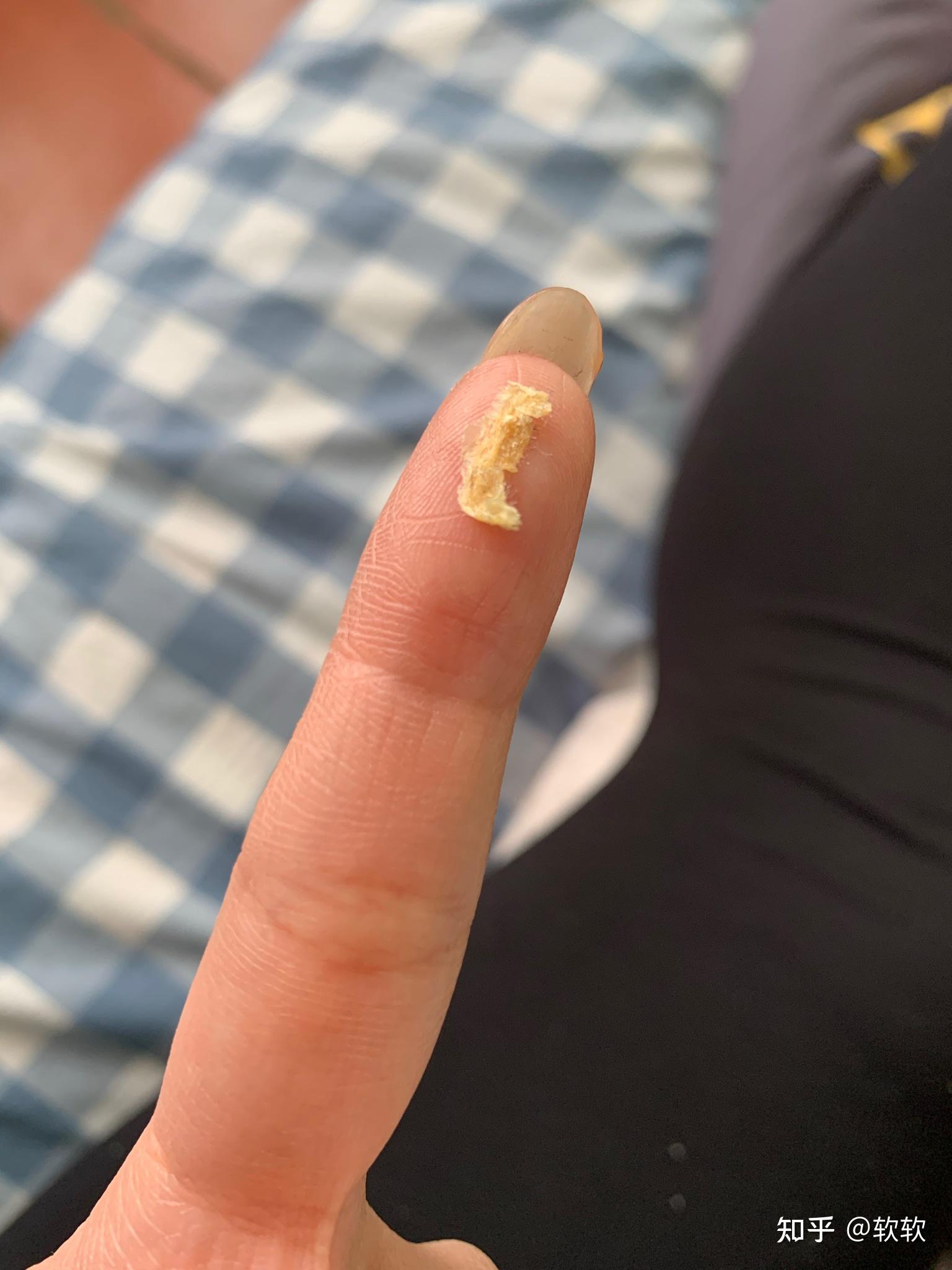 掏出一块超大耳屎,是种什么体验? - 知乎