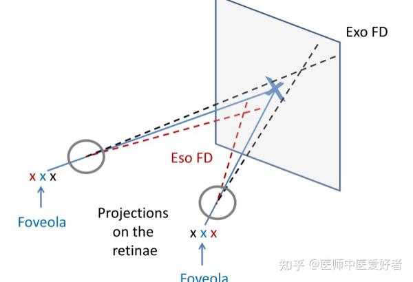 注视视差的检查及处理 - 知乎