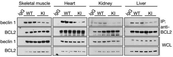 肾,肝)检测发现了突变的beclin 1与bcl2的蛋白相互作用有显著降低 图