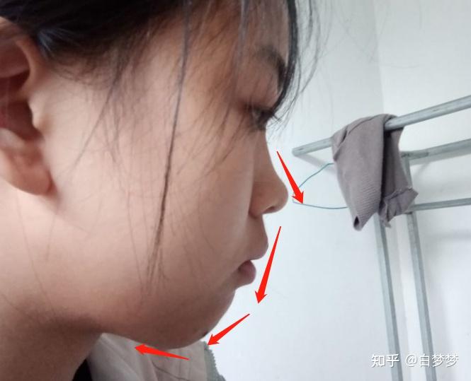 侧脸真的好丑啊其实看我正脸有挺多人夸过好看的本人高三党高考完后想