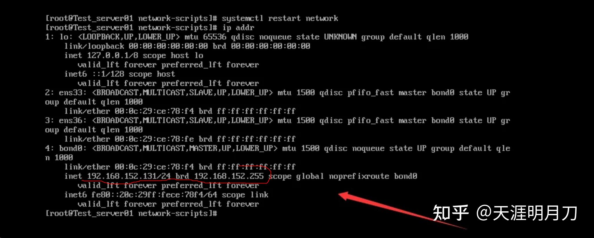 Linux bond0 