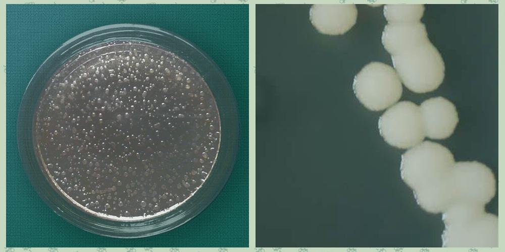 专业分析胶冻样类芽孢杆菌的来龙去脉