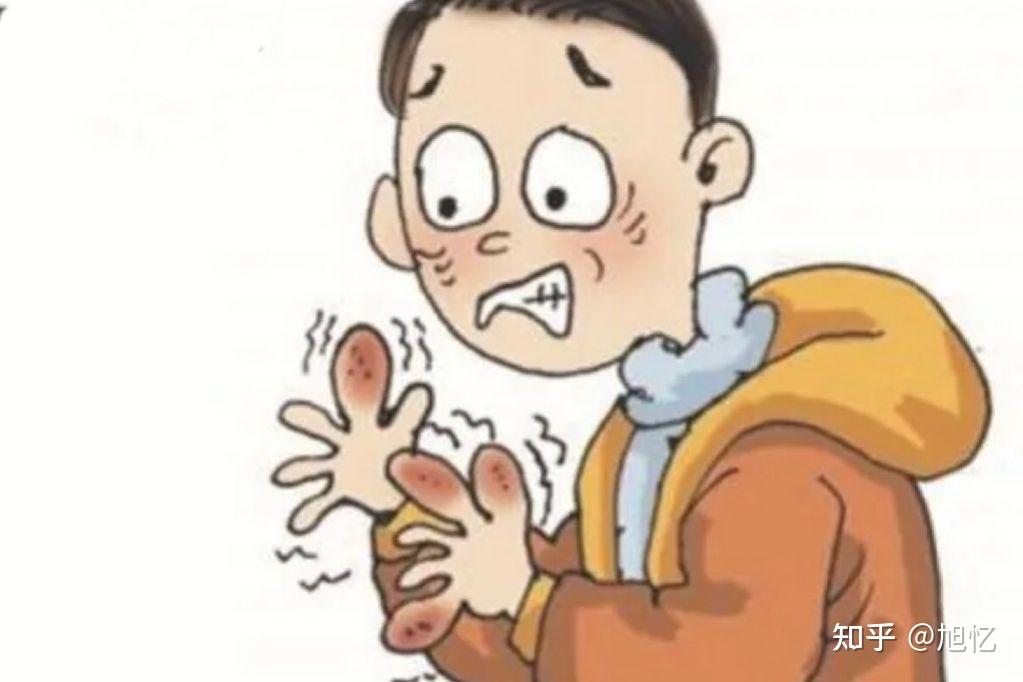 冻疮什么药好用? - 知乎