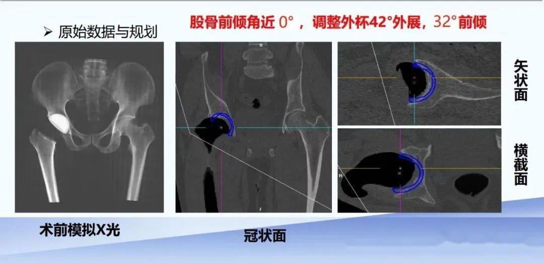 機械臂精準定位到預期規劃位置,完成