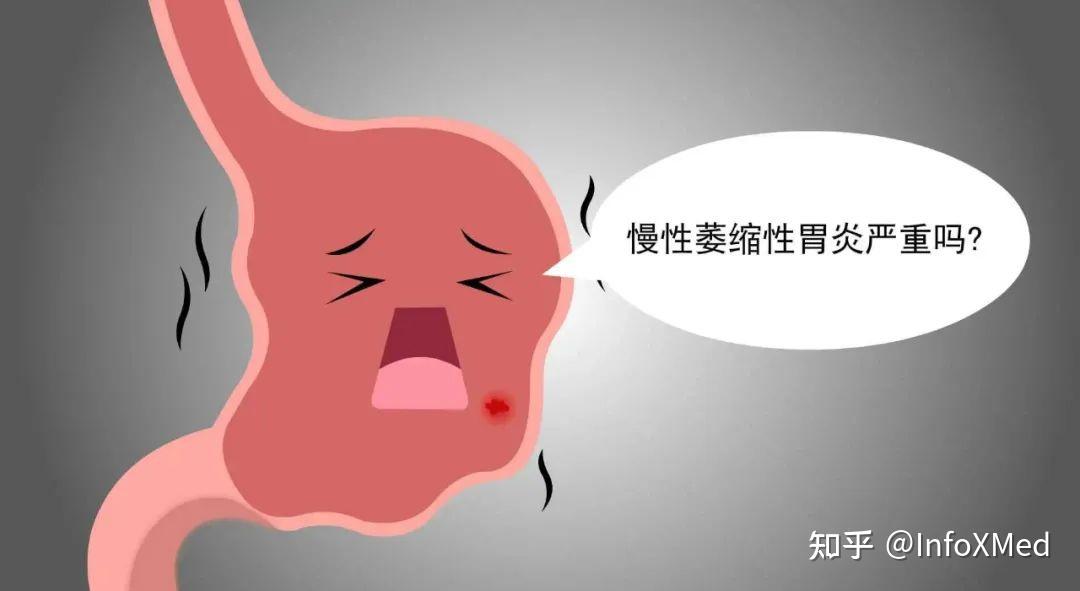 慢性萎縮性胃炎(chronic atrophic gastritis,cag)以胃黏膜腺體減少為