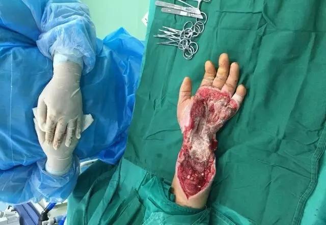 医生手机里珍藏的都是哪些病例