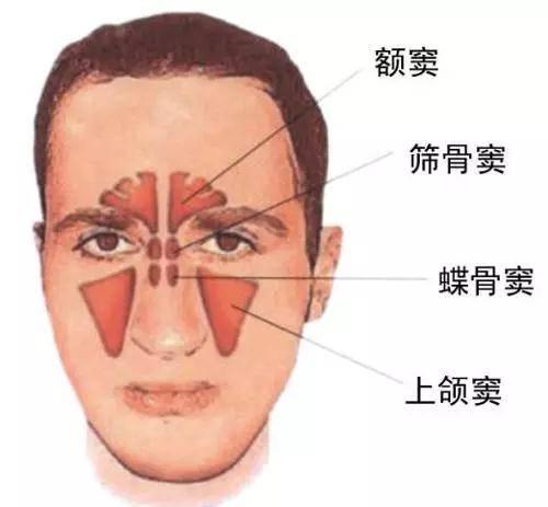 鼻窦炎会引起视力下降