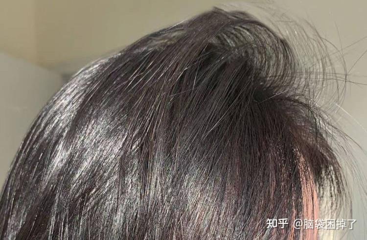 油性发质,但是头发发梢特别干,特别容易打结,有没有什么适合油头用的