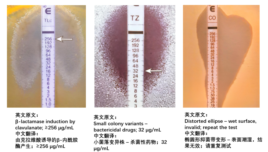 E Test Examples 【收藏】超全的E-TEST条的读取方法,有图有解释 - 知乎