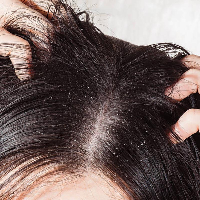 秋天头皮发痒护发产品你用对了吗