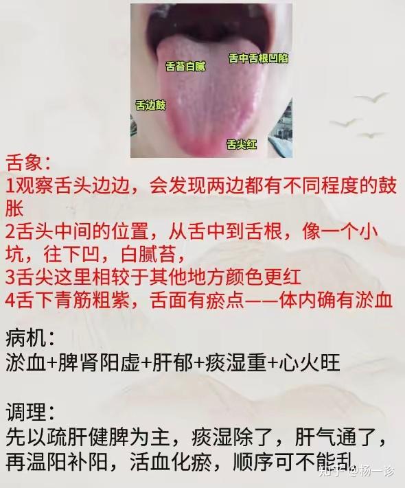 这种舌头,如果只看青筋粗紫,只会做很多无用功,原因就在舌头上 今天就用一张图,给大家讲讲 - 知乎