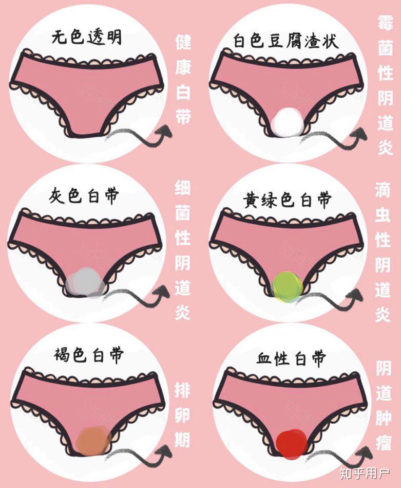 女性下体异味如何解决？