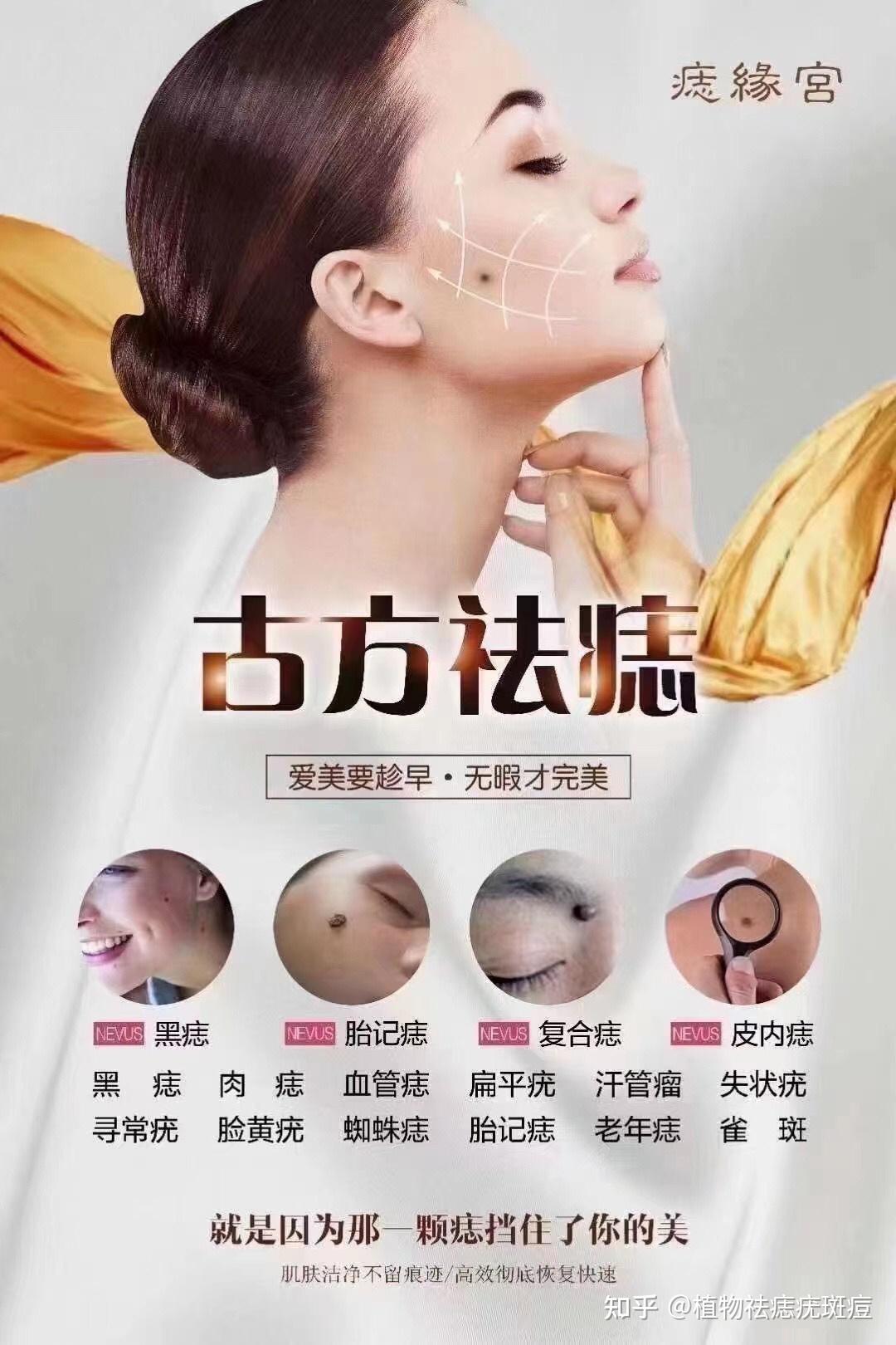 专业祛痣,可洗脸化妆不忌口