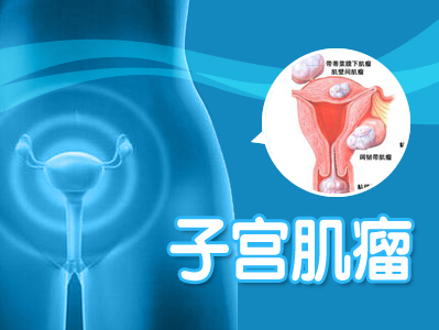 子宫肌瘤多大需要做宫腔镜手术 知乎 子宫肌瘤多大需要做宫腔镜手术 知乎