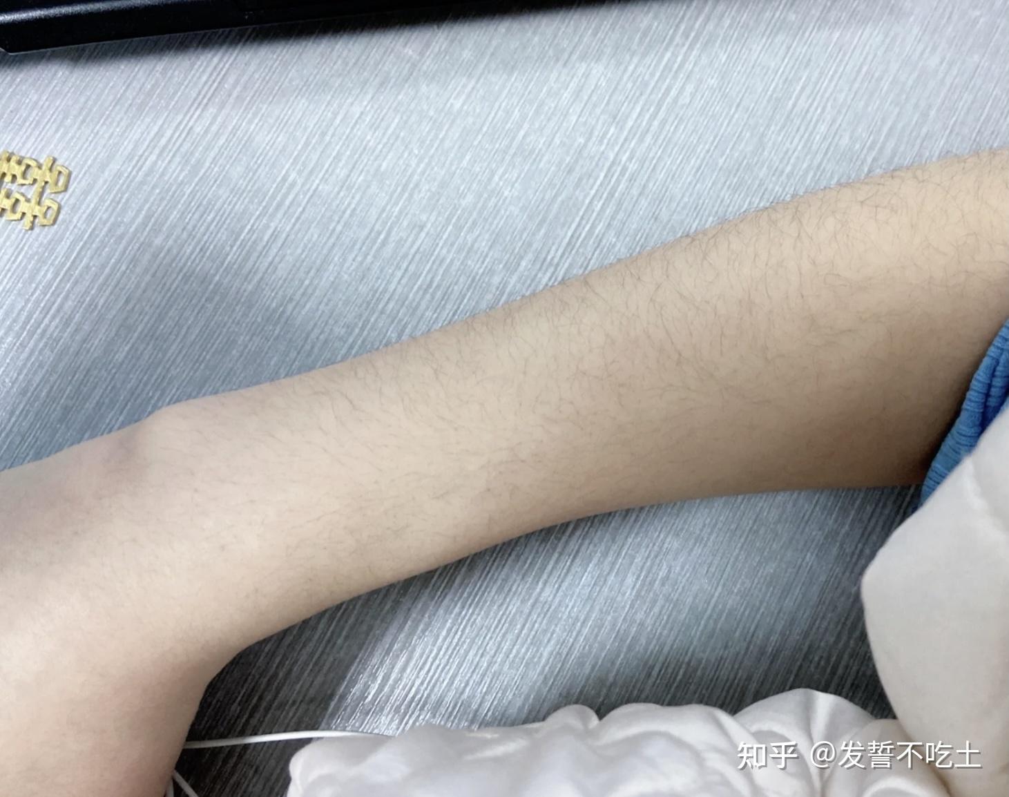 女生怎么脱腋毛?有什么靠谱的脱毛膏推荐? - 知乎