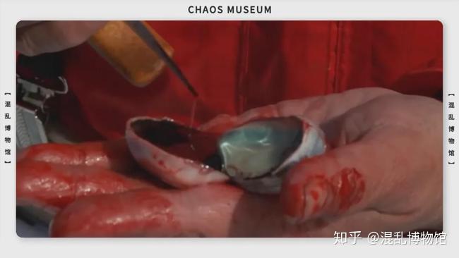 人类可以只吃肉不吃菜吗? 12 v2 cf522e405a78c698ad3c2ab14b12f049 720w