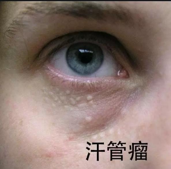 v2-cf630174c97c956f718eff10a9f20092_1440w.jpg?source=172ae18b
