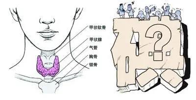 v2-cf873ef573912ebafdcf159da8afc54c_1440w.jpg?source=172ae18b