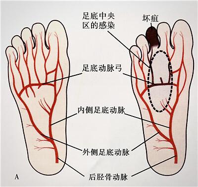 v2-cf93d7ffd8fca493d861f29ddb18e110_1440w.jpg?source=172ae18b