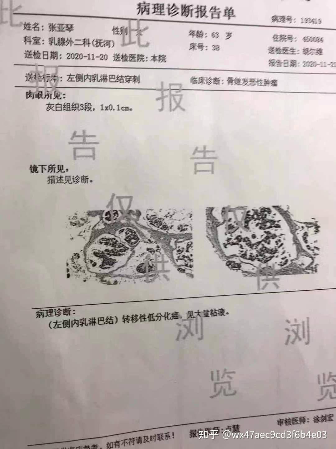 记录妈妈乳腺癌骨转移求医之路 